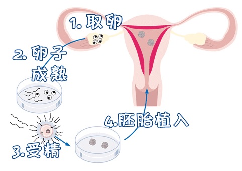 生殖医学中心